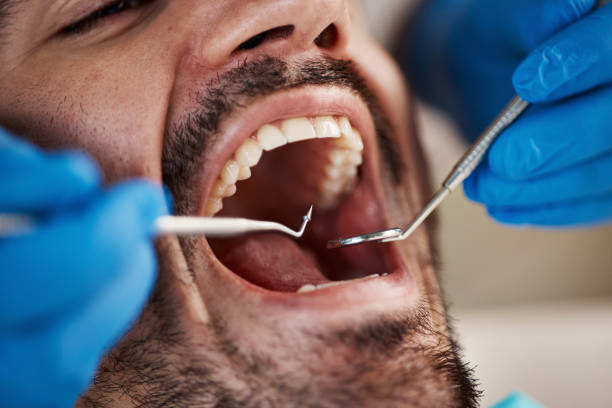 Best Same-Day Emergency Dentist in Scottville, MI